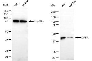 Western blotting analysis using DFFA antibody (ABIN7798364).