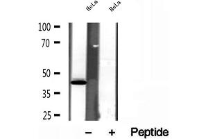 Western blot analysis of extracts of HeLa cells, using SPOP antibody. (SPOP-B anticorps  (Internal Region))