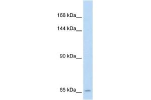 SLC19A1 antibody used at 5 ug/ml to detect target protein.