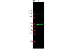 Image no. 1 for anti-Protein S (PROS) (AA 16-25) antibody (ABIN199929) (PROS1 anticorps  (AA 16-25))