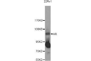 Western blot analysis of extracts of 22RV1 cells, using AR Antibody (ABIN5971084) at 1/500 dilution. (Androgen Receptor anticorps)