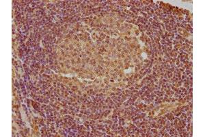 IHC image of ABIN7144464 diluted at 1:740 and staining in paraffin-embedded human lymph node tissue performed on a Leica BondTM system.