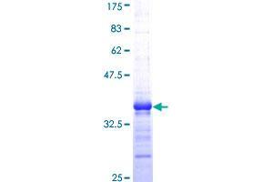Image no. 1 for V-Yes-1 Yamaguchi Sarcoma Viral Oncogene Homolog 1 (YES1) (AA 1-80) protein (GST tag) (ABIN1325513)