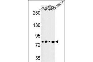 Western blot analysis of CSRP2BP Antibody (Center) (ABIN652812 and ABIN2842530) in Y79, , , MDA-M cell line lysates (35 μg/lane). (CSRP2BP anticorps  (AA 246-275))