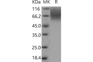 Western Blotting (WB) image for Carcinoembryonic Antigen-Related Cell Adhesion Molecule 1 (CEACAM1) protein (His tag) (ABIN7321183)