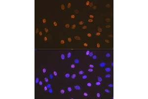 Immunofluorescence analysis of C6 cells using SOX10 Rabbit mAb (ABIN7270567) at dilution of 1:100 (40x lens). (SOX10 anticorps)