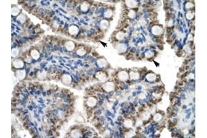 C20ORF100 antibody was used for immunohistochemistry at a concentration of 4-8 ug/ml to stain Epithelial cells of intestinal villus (arrows) in Human Intestine. (TOX2 anticorps  (N-Term))