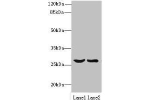 Western blot All lanes: OCIAD1 antibody at 1 μg/mL Lane 1: Mouse liver tissue Lane 2: Mouse kidney tissue Secondary Goat polyclonal to rabbit IgG at 1/10000 dilution Predicted band size: 28, 21, 22 kDa Observed band size: 28 kDa