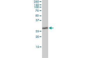 TXNDC9 monoclonal antibody (M02), clone 1E8-7C12 Western Blot analysis of TXNDC9 expression in K-562 .