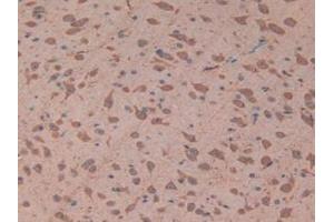 IHC-P analysis of Mouse Brain Tissue, with DAB staining. (TOLLIP anticorps  (AA 19-254))