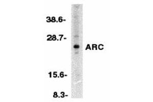 Western Blotting (WB) image for anti-ARC (N-Term) antibody (ABIN1031239) (ARC (N-Term) anticorps)