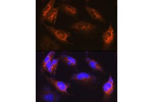 Immunofluorescence analysis of U-251MG cells using  Rabbit pAb (ABIN6131182, ABIN6136830, ABIN6136831 and ABIN6222940) at dilution of 1:100 (40x lens). (ALS2 anticorps  (AA 1-280))