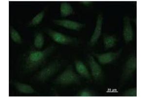 Immunostaining analysis in HeLa cells.