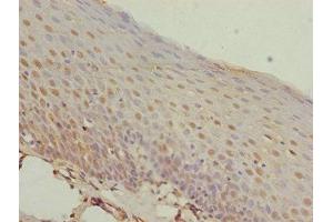 Immunohistochemistry of paraffin-embedded human tonsil tissue using ABIN7155798 at dilution of 1:100 (MEOX1 anticorps  (AA 1-254))