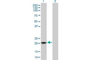 Western Blot analysis of MGMT expression in transfected 293T cell line by MGMT MaxPab polyclonal antibody. (MGMT anticorps  (AA 1-207))