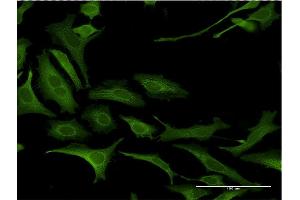 Immunofluorescence of monoclonal antibody to NDN on HeLa cell.