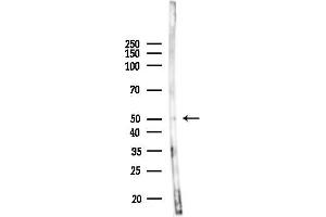 anti-Ets Variant 6 (ETV6) (Internal Region) antibody