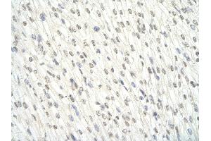 Rabbit Anti-EWSR1 antibody   Paraffin Embedded Tissue: Human Heart cell Cellular Data: cardiac cell of renal tubule Antibody Concentration: 4.