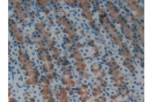DAB staining on IHC-P; Samples: Rat Stomach Tissue (Hepcidin anticorps  (AA 23-84))