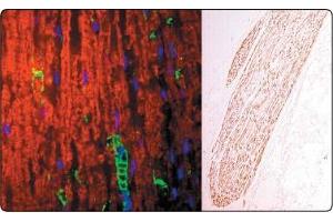 In the Left panel (a tissue section through an adult sciatic nerve), Po (green staining) can be seen in the myelin and Schwann cell processes surrounding the nodes of Ranvier.