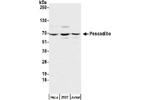 Western Blotting (WB) image for anti-Pescadillo Homolog 1 (PES1) (C-Term) antibody (ABIN7451951)