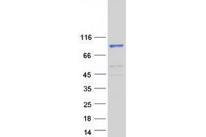 Validation with Western Blot