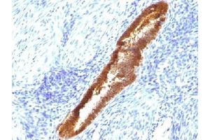 IHC testing of FFPE human endometrium with ASRGL1 antibody (clone CRASH/1289).