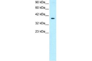 WB Suggested Anti-NT5C3 Antibody Titration:  0.