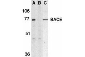 Image no. 1 for anti-Beta-secretase 1 (BACE1) (C-Term) antibody (ABIN204488) (BACE1 anticorps  (C-Term))