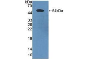 Detection of Recombinant PDCD6IP, Human using Polyclonal Antibody to Programmed Cell Death Protein 6 Interacting Protein (PDCD6IP) (ALIX anticorps  (AA 174-383))