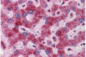 Human Liver: Formalin-Fixed, Paraffin-Embedded (FFPE)