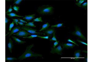Immunofluorescence of purified MaxPab antibody to NMI on HeLa cell. (NMI anticorps  (AA 1-307))