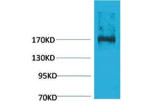 Western Blotting (WB) image for anti-Ectopic P-Granules Autophagy Protein 5 Homolog (EPG5) antibody (ABIN3181523) (EPG5 anticorps)