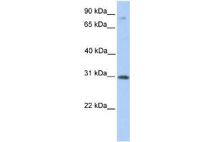 Human Placenta; WB Suggested Anti-ABHD13 Antibody Titration: 0. (ABHD13 anticorps  (C-Term))