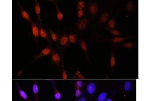 Immunofluorescence analysis of NIH/3T3 cells using KAT6A Polyclonal Antibody at dilution of 1:100. (MYST3 anticorps)