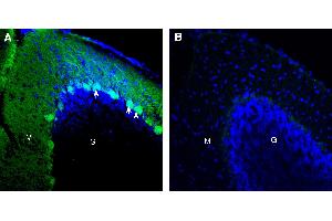 Expression of CD38 in mouse cerebellum. (CD38 anticorps  (Extracellular))