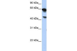 WB Suggested Anti-BAT5 Antibody Titration:  0. (BAT5 anticorps  (Middle Region))