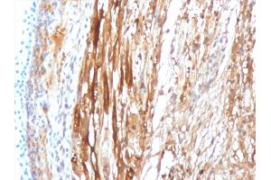 Formalin-fixed, paraffin-embedded Rat Heart Muscle stained with Crystallin Alpha B Mouse Monoclonal Antibody (CPTC-CYRAB-1).