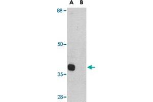 Western blot analysis of ATG12 in mouse heart tissue lysate with ATG12 polyclonal antibody  at 1 ug/mL in (A) the absence and (B) the presence of blocking peptide. (ATG12 anticorps  (Internal Region))