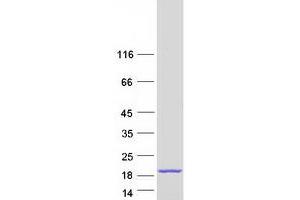 Validation with Western Blot