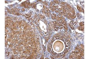 IHC-P Image Septin 2 antibody [N1N3] detects Septin 2 protein at cytosol on mouse ovary by immunohistochemical analysis. (Septin 2 anticorps)