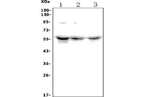 Western blot analysis of CDK16 using anti-CDK16 antibody (ABIN7601590).