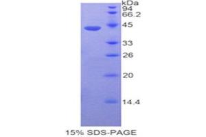SDS-PAGE (SDS) image for Fibulin 4 (FBLN4) (AA 17-169) protein (His tag,GST tag) (ABIN1877876) (FBLN4 Protein (AA 17-169) (His tag,GST tag))
