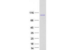 Validation with Western Blot