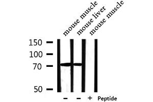 Western blot analysis of extracts from mouse muscle,mouse liver, using PABPC4 Antibody.