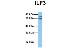 Host:  Rabbit  Target Name:  ILF3  Sample Tissue:  Human Stomach Tumor  Antibody Dilution:  1. (Interleukin enhancer-binding factor 3 (ILF3) (N-Term) anticorps)