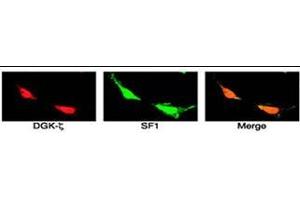 SF1 colocalizes with DGK and  in the nuclei of H295R cells. (DGKZ anticorps  (C-Term))