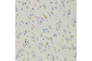 Immunohistochemistry of paraffin-embedded mouse brain using RAE1 antibody (ABIN5974056) at dilution of 1/100 (40x lens). (RAE1 anticorps)