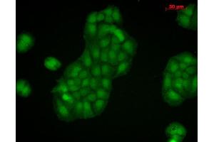 Immunocytochemistry/Immunofluorescence analysis using Rabbit Anti-Calnexin-CT Polyclonal Antibody . (Calnexin anticorps  (C-Term) (PE))
