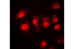Immunofluorescent analysis of STAT3 staining in A549 cells. (STAT3 anticorps  (C-Term))